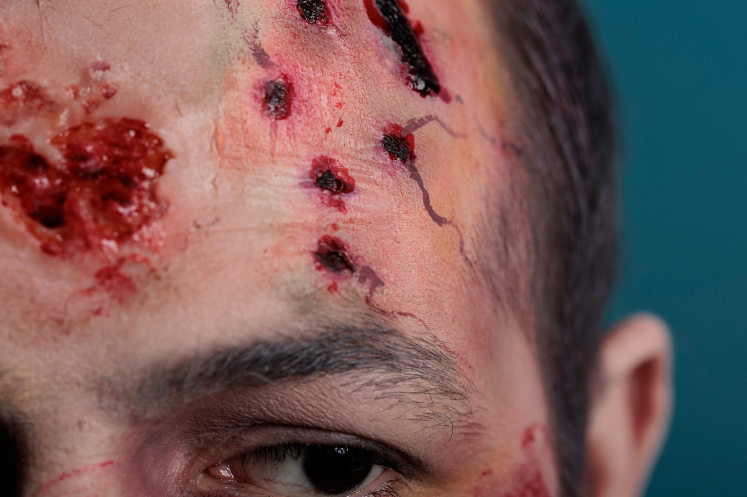Facial Trauma/Scars