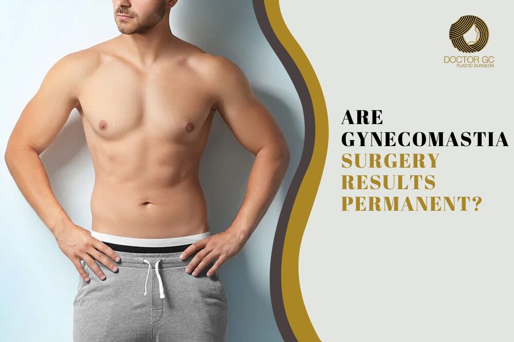 Are Gynecomastia Surgery Results Permanent?