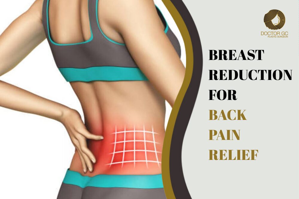 Breast Reduction for Back Pain Relief