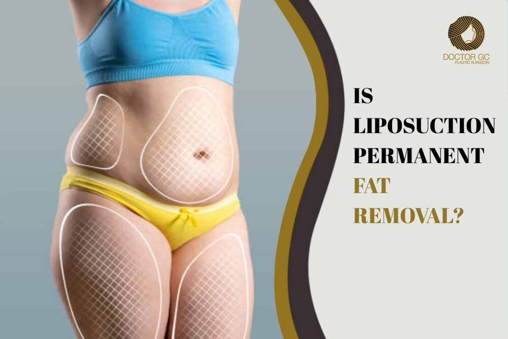 Breast Reduction for Back Pain Relief