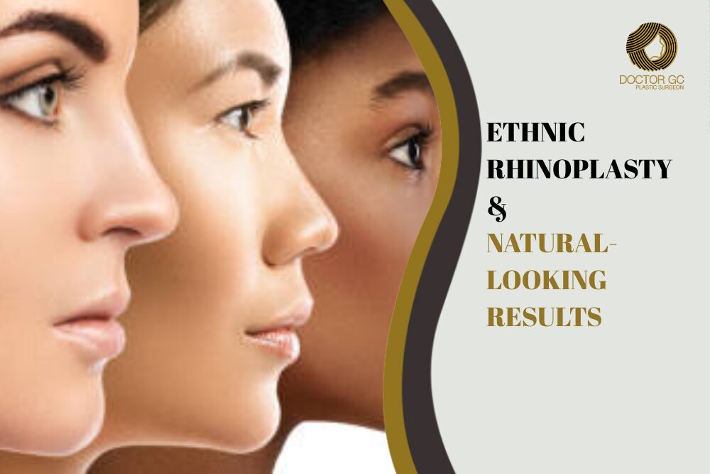 Ethnic Rhinoplasty & Natural-Looking Results