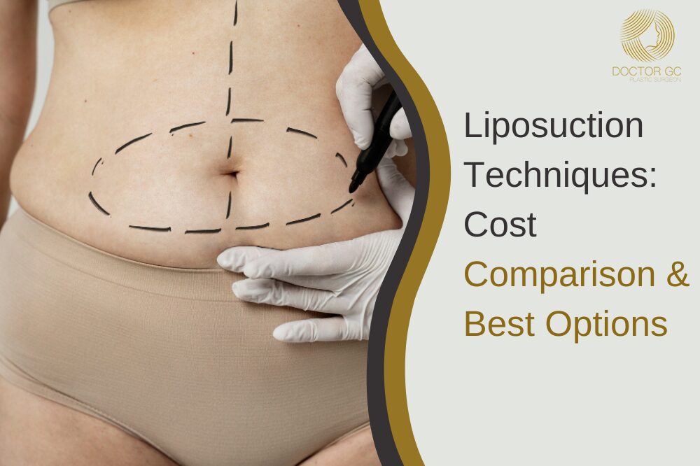 Best Liposuction Surgery in Delhi