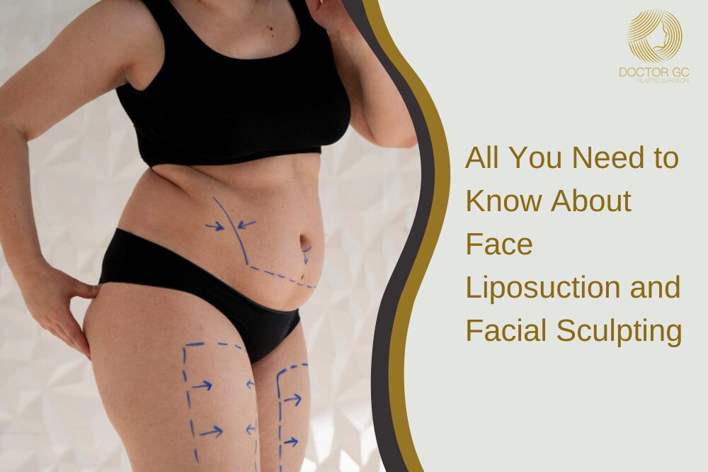 Liposuction
