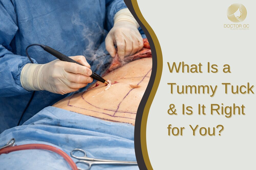 Tummy Tuck Operation