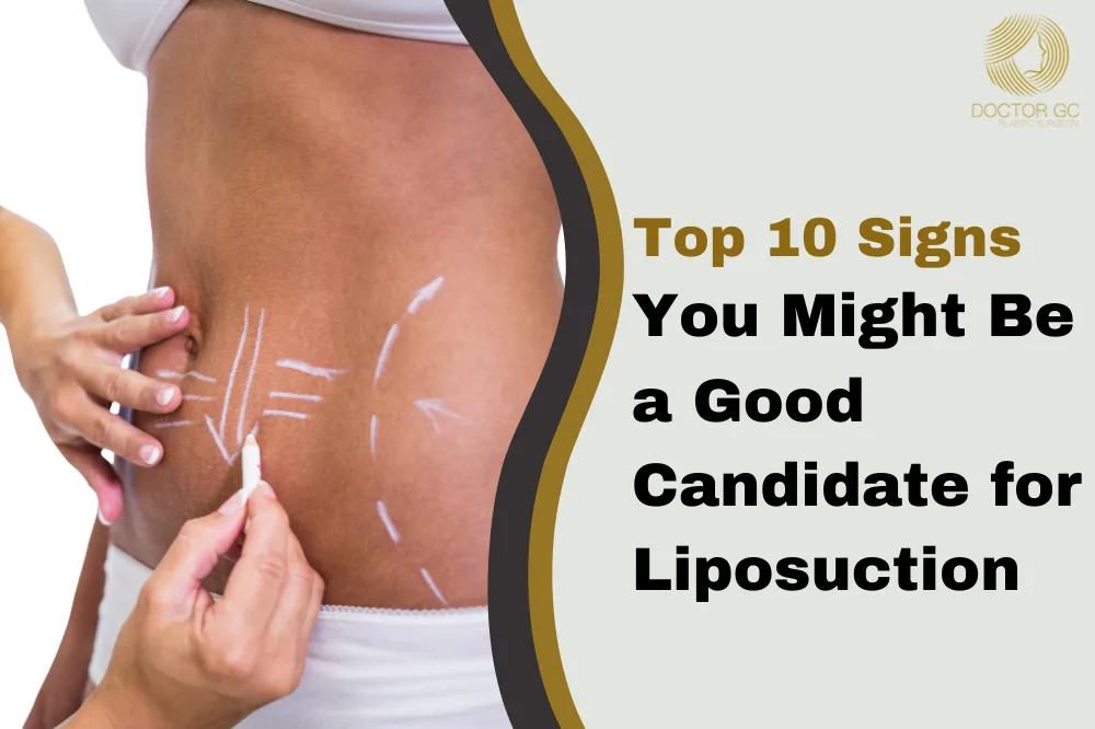 signs you need liposuction surgery