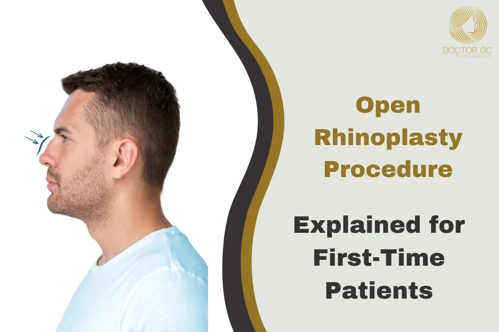 Open Rhinoplasty