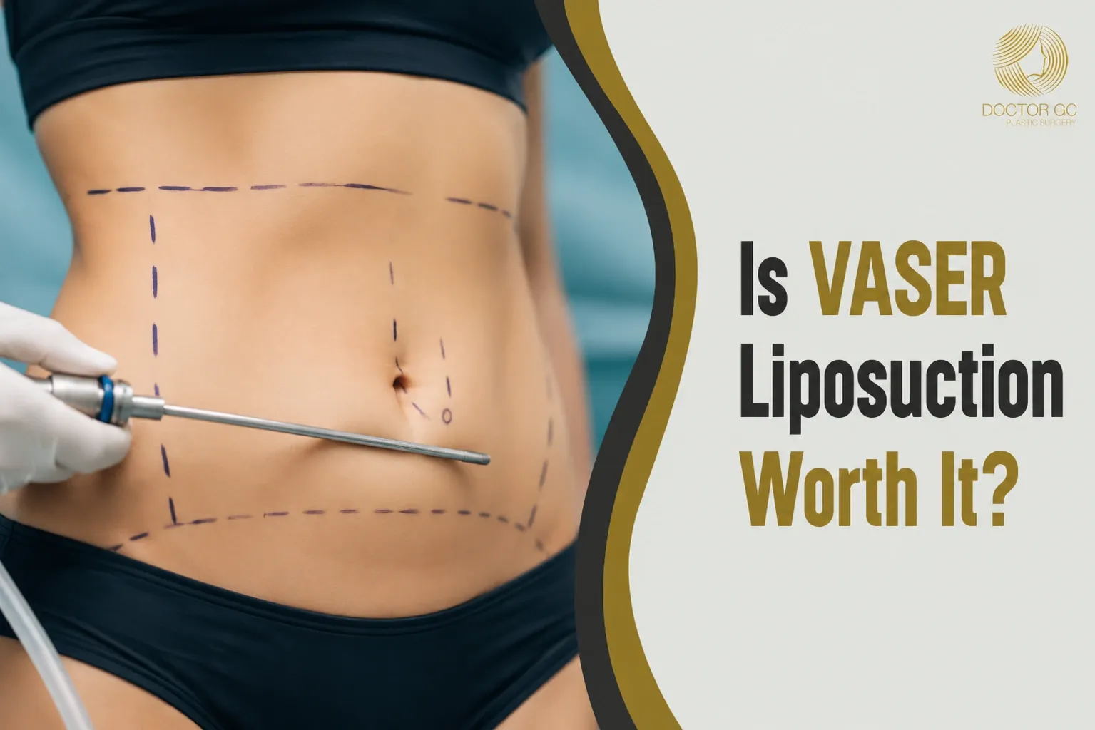 VASER Liposuction