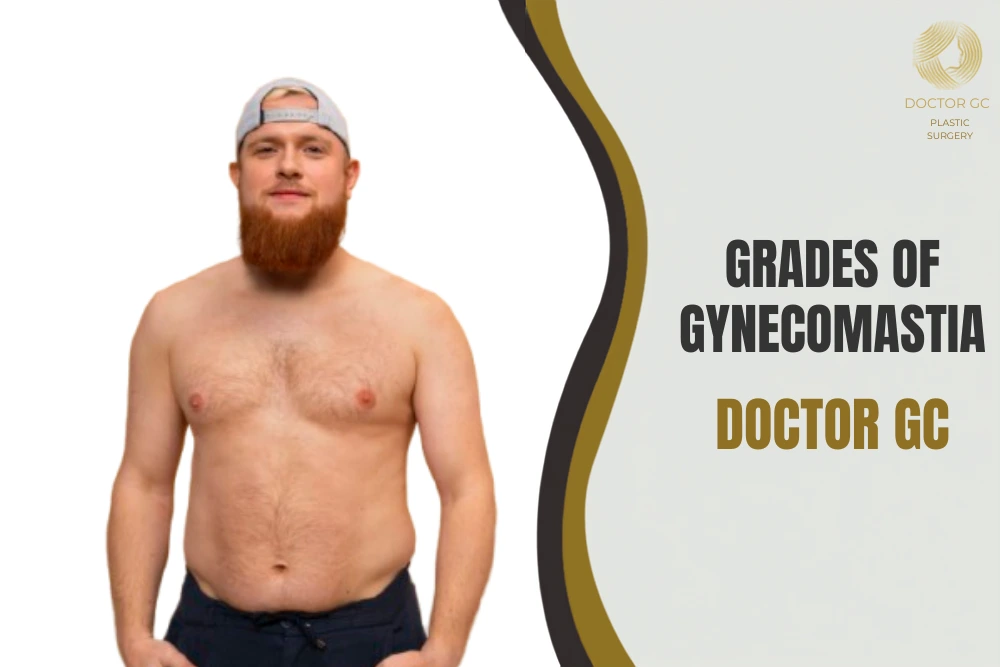 Grades of Gynecomastia
