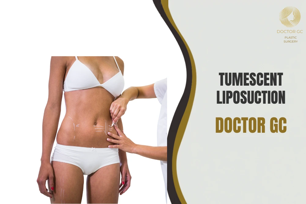 Tumescent Liposuction